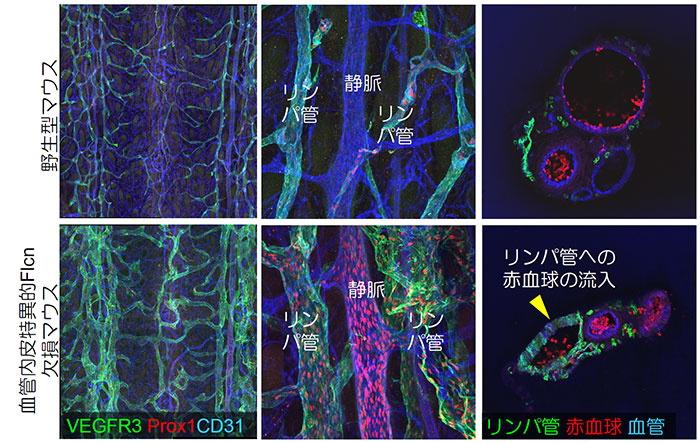 リンパ管の発生と解剖